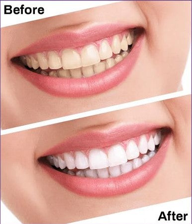 Premium Teeth Whitening Serum 30ml Purple Pump Bottle